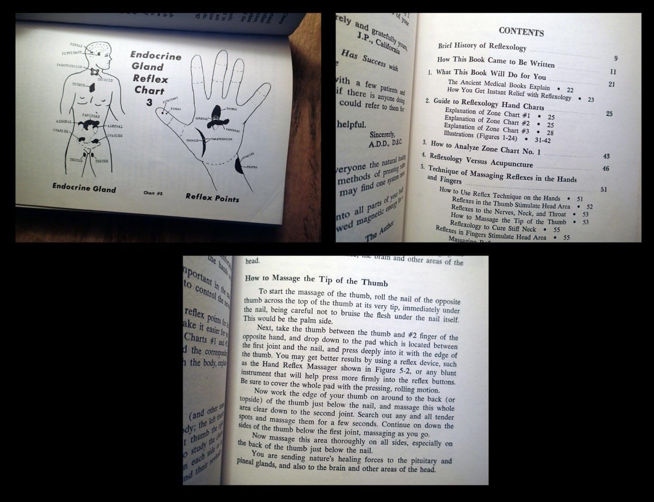 Hand Reflexology: Key to Perfect Health